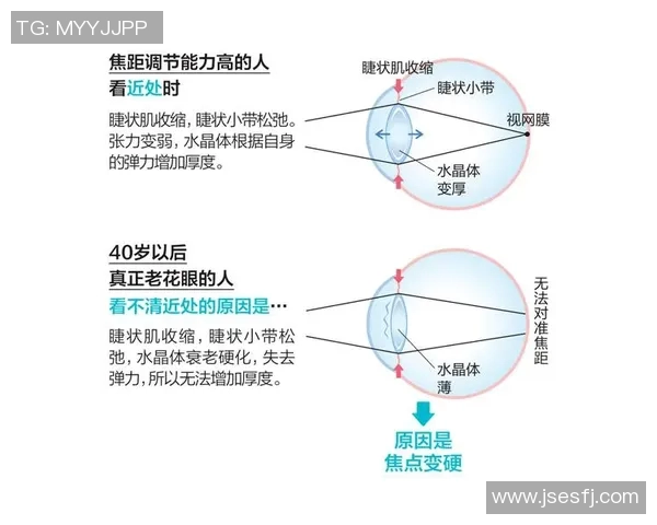 健身运动对改善视力的影响